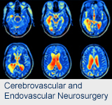 Cerebrovascular and Endovascular Neurosurgery